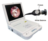 Ent Medical Endoscòpic Camera System