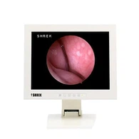 Micromonitors mèdics Monitor endoscòpic